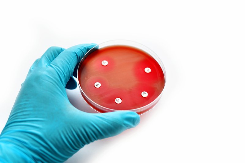 Antibiotico-resistenza