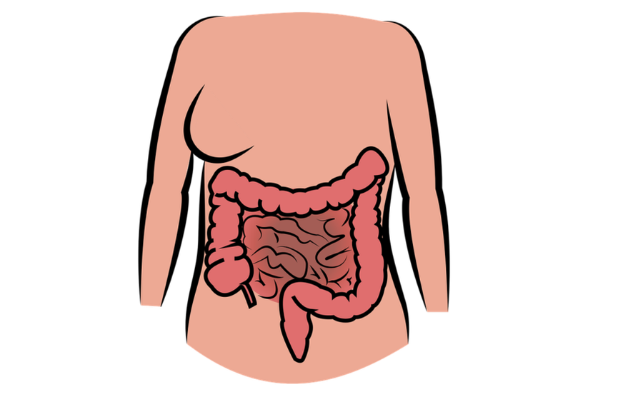 tumore colon retto