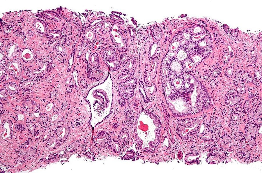 Di Nephron - Opera propria, CC BY-SA 3.0, https://commons.wikimedia.org/w/index.php?curid=10613950