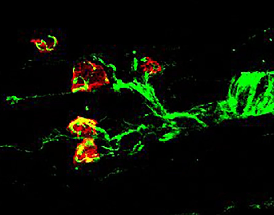 Il trattamento con MR-409 ha migliorato l’innervazione dei muscoli scheletrici