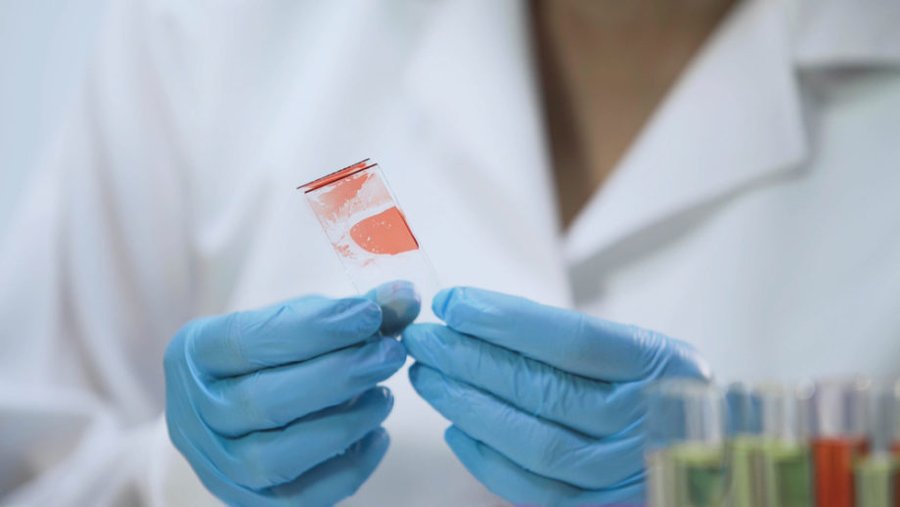 screening epatite C