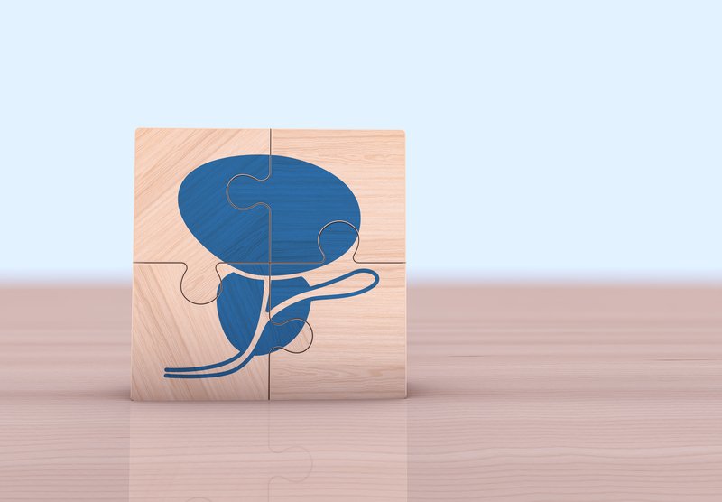 intelligenza artificiale prostata